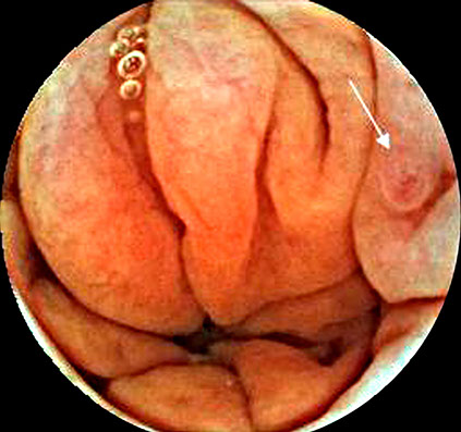 omom7